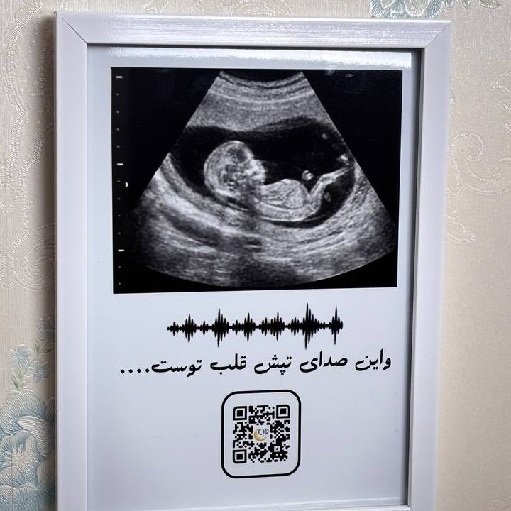 تابلو سونوگرافی موزیکال با صدای ضربان قلب یادگاری خاص دوران بارداری