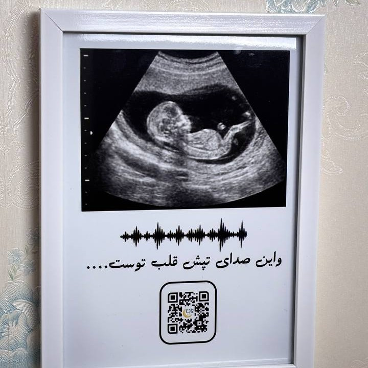 تابلو سونوگرافی موزیکال با صدای ضربان قلب یادگاری خاص دوران بارداری