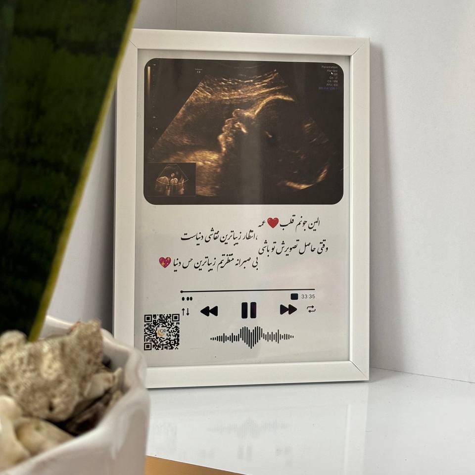 قاب موزیکال سونو Baby با صدای ضربان قلب هدیه خاص دوران بارداری