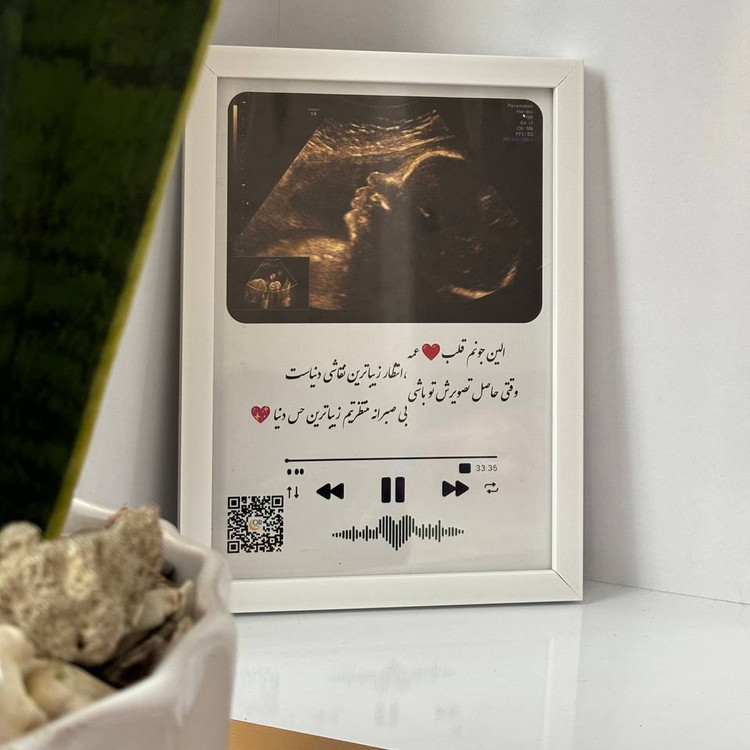قاب موزیکال سونو Baby با صدای ضربان قلب هدیه خاص دوران بارداری