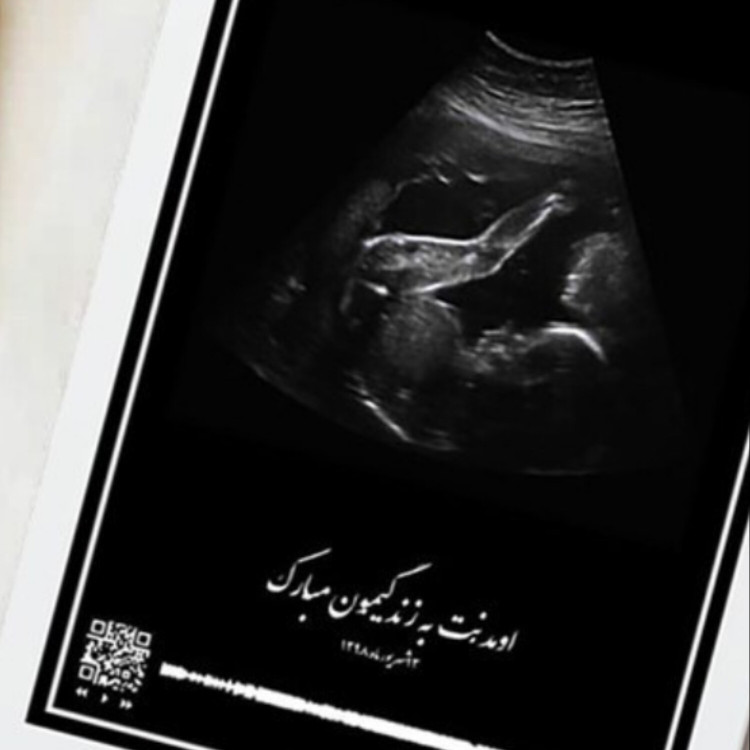 قاب موزیکال سونوگرافی بارکد صدای ضربان قلب جنین شما