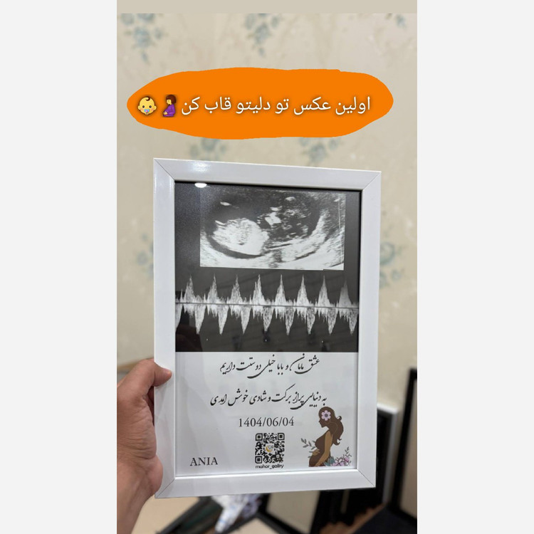 قاب موزیکال سونوگرافی بارکد صدای ضربان قلب جنین شما